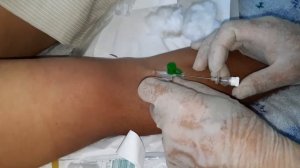 ВНУТРИВЕННАЯ ИНЪЕКЦИЯ (ВЕНЕПУНКЦИЯ, ИНФУЗИЯ) Укол