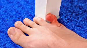 ЛАЙФХАКИ ДЛЯ ПЕРВОЙ ПОМОЩИ || 23 БЕЗОПАСНЫХ ТРЮКА ПРОТИВ РАСПРОСТРАНЕННЫХ ПРОБЛЕМ