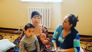 Результаты от гидроцефалии у ребенка. Узбекистан.