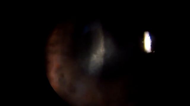 Синдром Шегрена смотреть онлайн