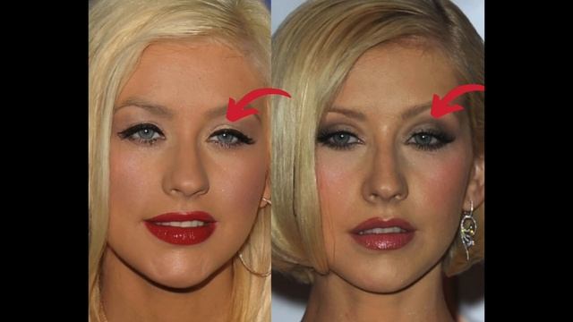 Christina Aguilera: Plastic Surgery (2002-2020) смотреть онлайн