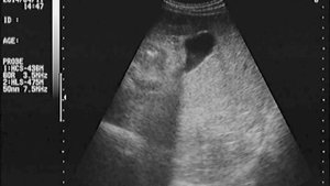 Левое подреберье