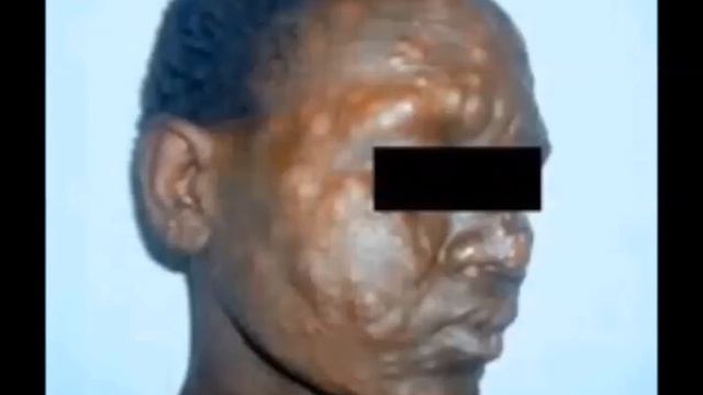 Top 5 Weird and strange medical diseases смотреть онлайн