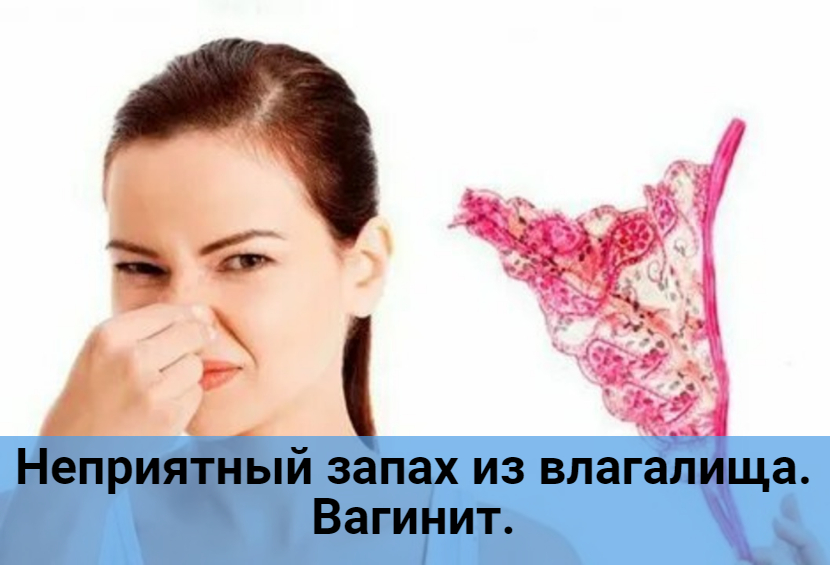 Неприятный запах с влагалища. Выделения с запахом тухлой рыбы. Выделения с неприятным запахом. С запахом гнилой рыбы выделения.