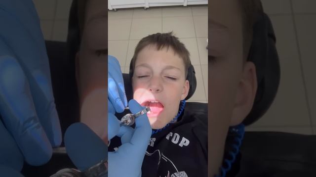 Дети боятся стоматолога? #стоматология #shorst #short смотреть онлайн