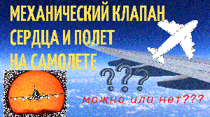 Можно ли летать на самолете людям с искусственным клапаном сердца? Жизнь клапанщика.