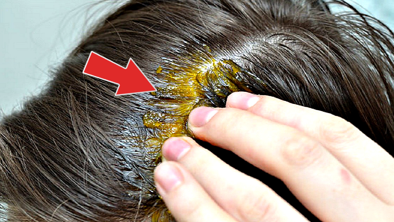 Волосы отрастут за 2 недели! Просто нужно втирать эту секретную маску в корни! Маска для роста волос смотреть онлайн