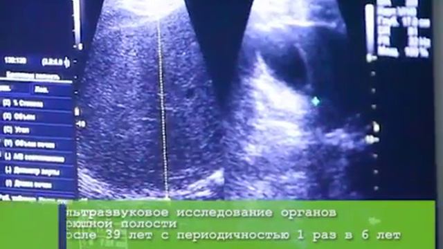 Диспансеризация населения Общая информация смотреть онлайн