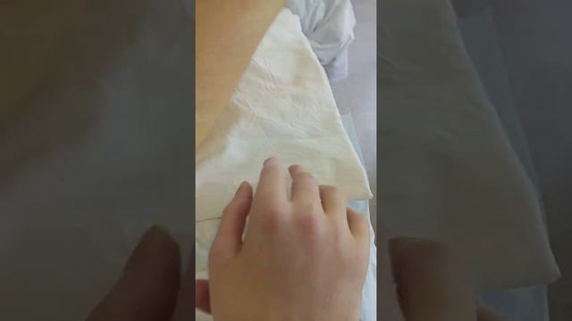 С Колей заметили как начал немного двигаться большой палец на правой руке и бицепс стал сильней смотреть онлайн