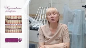 Художественная реставрация зубов