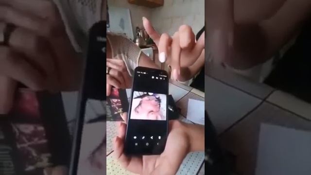 Отзыв/СКВ Системная красная волчанка/ Результат приема нано бальзамов #GlobalTrendCompany
