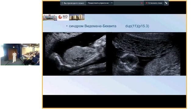 Ультразвуковое исследование плода в эпоху новых генетических технологий