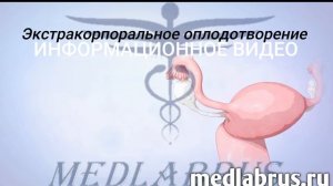 ЭКО или экстракорпоральное оплодотворение