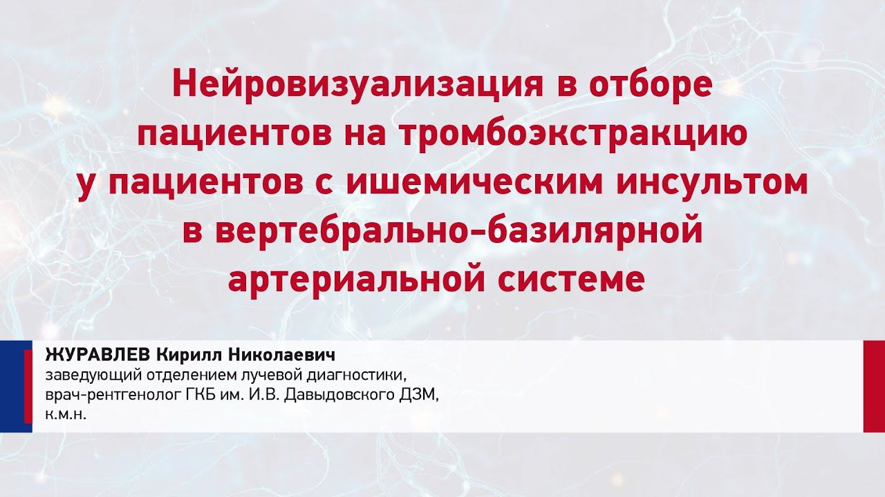 Журавлев К.Н. Нейровизуализация в отборе пациентов на ТЭ у пациентов с ИИ в ВБС