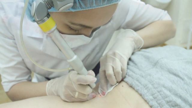 Удаление новообразований (родинок) в NEO-Clinic смотреть онлайн