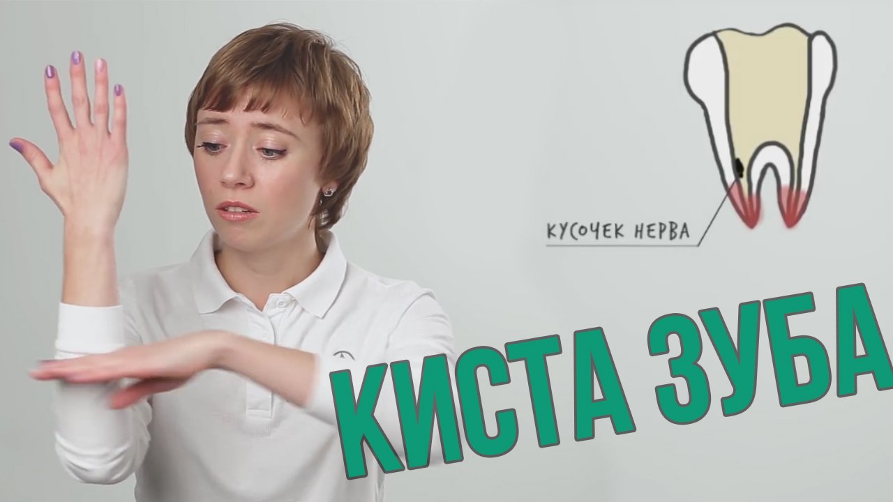 Как она образуется КИСТА ЗУБА (Школа здоровых зубов)