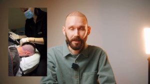 Это история о моей пересадке волос в Турции