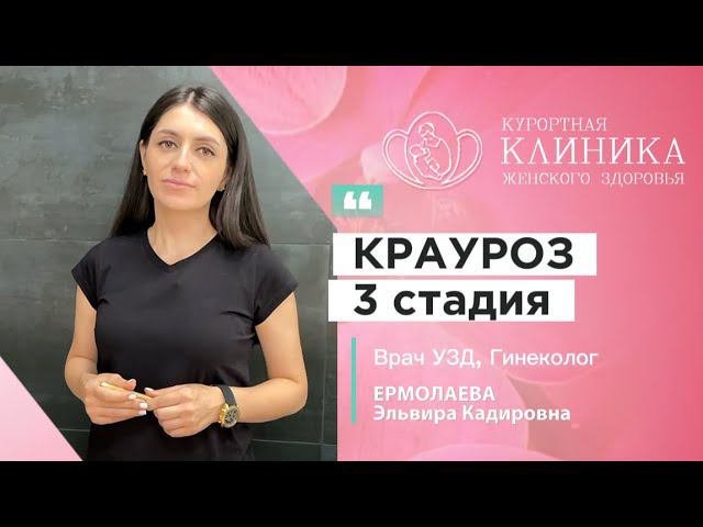 Врач эксперт гинеколог: о лечении крауроза вульвы и склеротического лихена [2024]