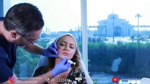 Cheeks & Jawline - Dr. Paulo Michels - Plastic Surgery - Abu Dhabi - UAE - YouTube