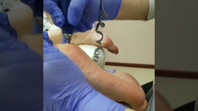 Педикюр дисками ПроПедикюр смотреть онлайн