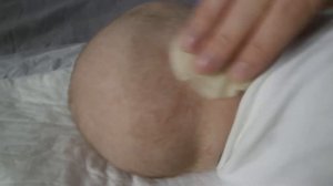 ПОТНИЦА У НОВОРОЖДЁННЫХ