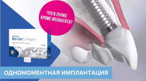 Одномоментная имплантация. Что в лунке кроме имплантата? Информационный фильм.