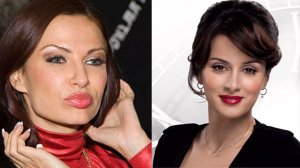 Эвелина Бледанс – Оправдания перед Канделаки