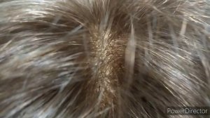 Парик из натуральных волос с эффектом кожи. Смотрится как настоящий.