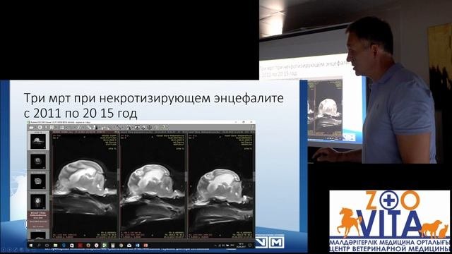 Эпилепсия с структурными нарушениями