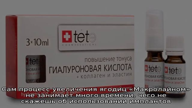 Увеличение ягодиц гиалуроновой кислотой смотреть онлайн