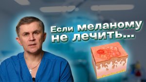 Если меланому не лечить... Рак кожи