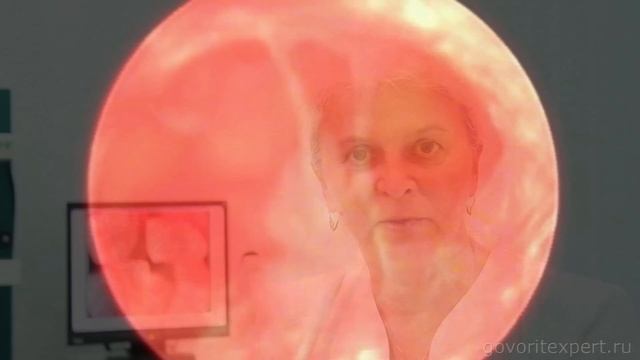 Что такое гистероскопия? Решение женских проблем. Говорит Эксперт смотреть онлайн