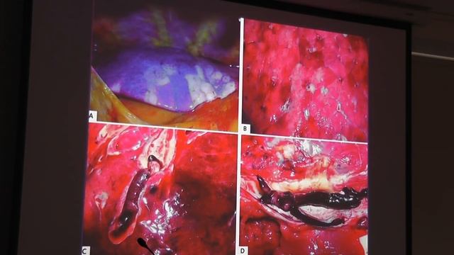 COVID-19 пневмония. Лекция академика РАН, профессора А.Г. Чучалина смотреть онлайн