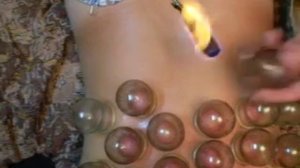 Ставим банки при простуде