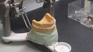 Пандент зуботехническая лаборатория