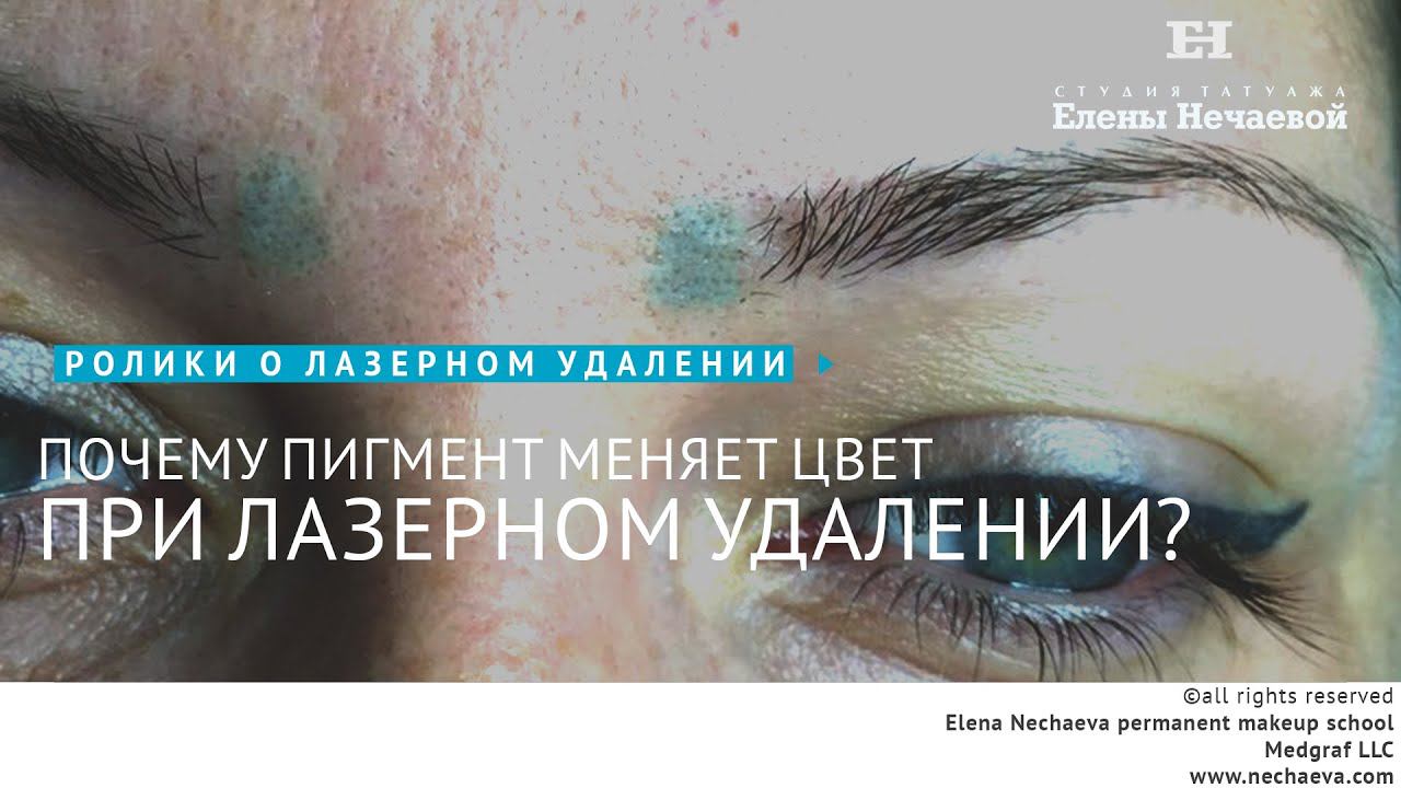 Почему пигмент меняет цвет при лазерном удалении? #татуаж #лазерноеудаление