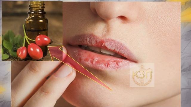 Обветренные губы заживают мгновенно после этого! Народные способы лечения обветренных губ и герпеса смотреть онлайн