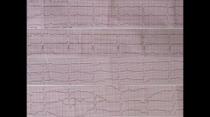 Повороты сердца