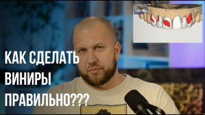 Подготовка под виниры для закрытой группы Как правильно делать waxup mockup ошибки врача и техника