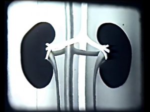 Строение и работа почек