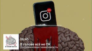 #1.7: "Дофаминовая зависимость"