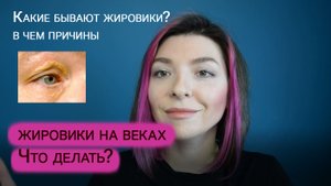 Жировики под глазами. Как избавиться, причины и мой опыт.