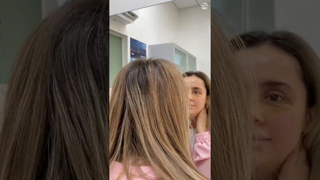 Ринопластика +верхняя блефаропластика смотреть онлайн