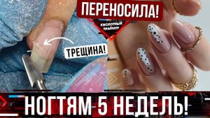 БЕДНЫЕ НОГТИ!? Ремонт натуральных ногтей? Быстрый дизайн ногтей и маникюр за 1 час?