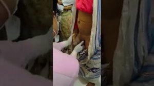 Examination Of Scrotal Swelling(Part-2) || Scrotal Swelling Short Case for Final Prof Examination