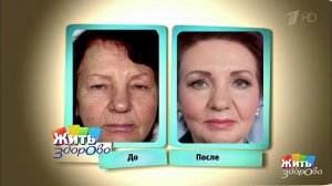 Химический пилинг. Жить здорово! Фрагмент выпуска от 07.06.2017