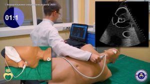 ЭХО КГ.  Парастернальный доступ - короткие оси левого желудочка