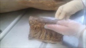 топографическая анатомия груди и средостенья