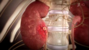 Вопросы о боли в спине. Камни в почках. Здоровье. Фрагмент выпуска от 17.04.2016