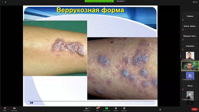 Дерматовенерология Лекция 2